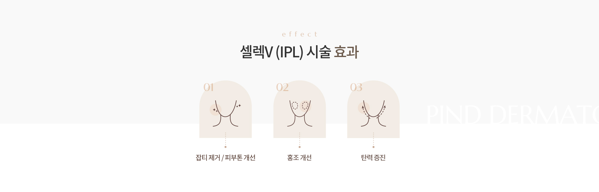 셀렉V (IPL) 상세02