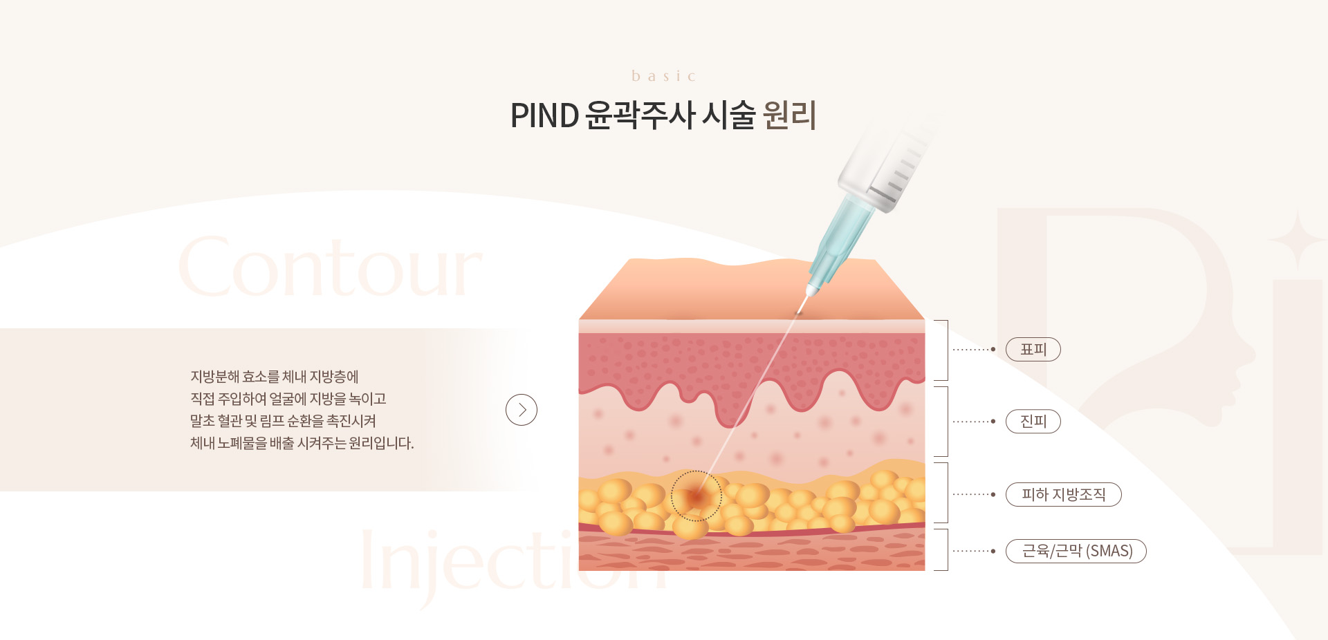 PIND 윤곽주사 상세03