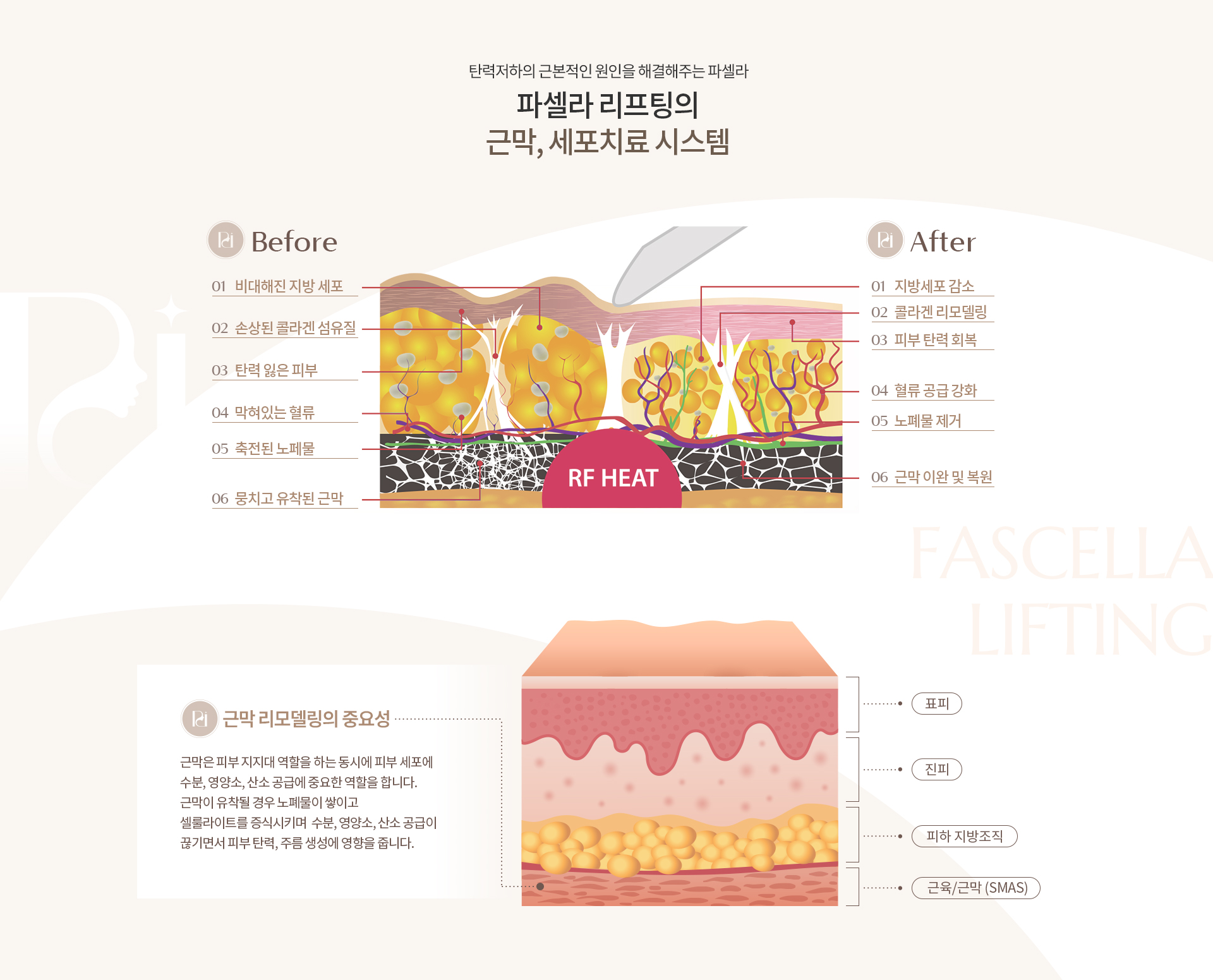파셀라 리프팅 상세03