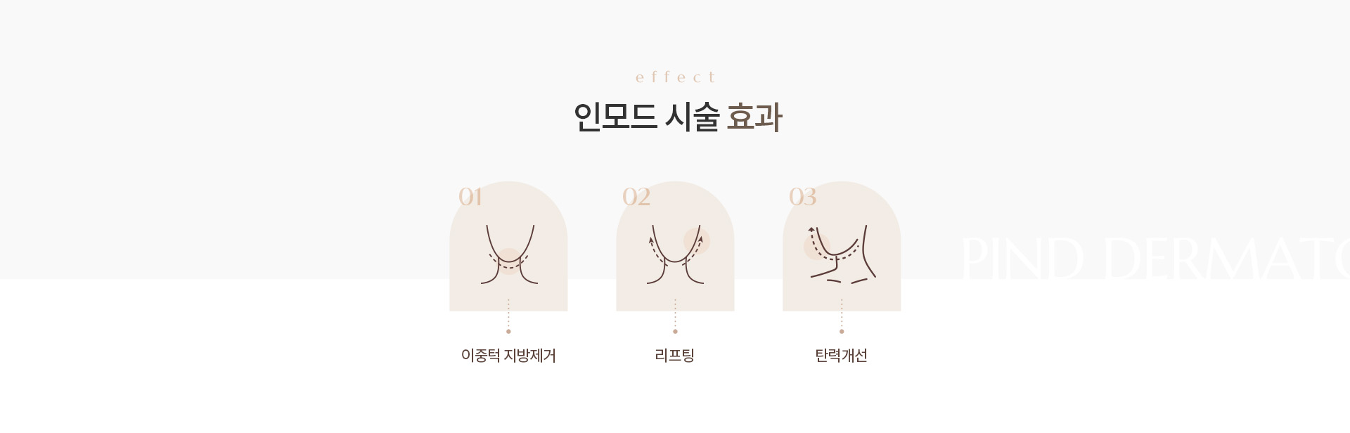 인모드 리프팅 상세02