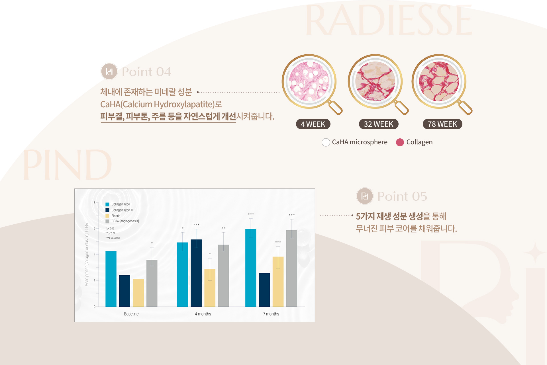 레디어스 상세04