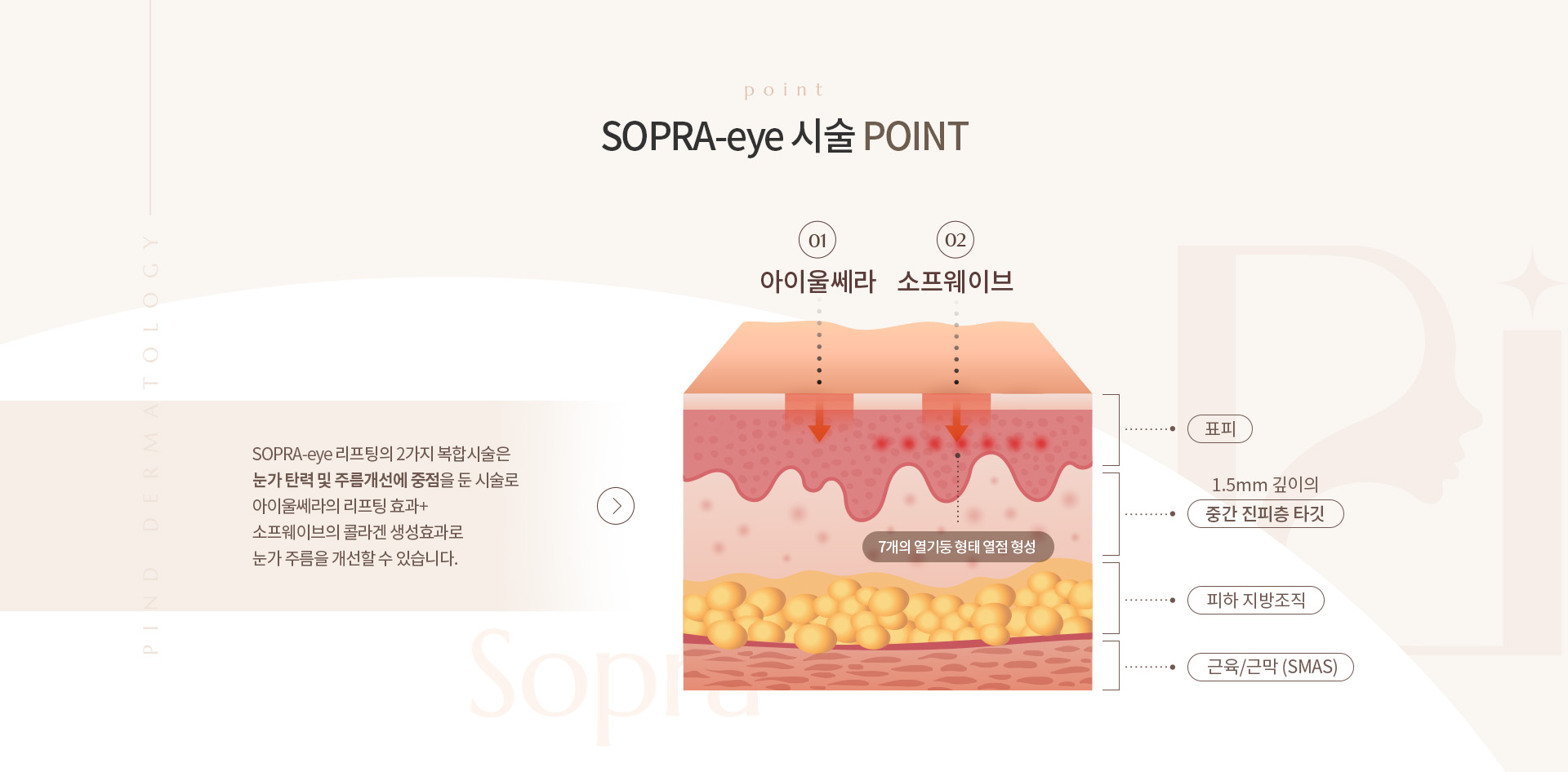 SOPRA-Eye 상세03