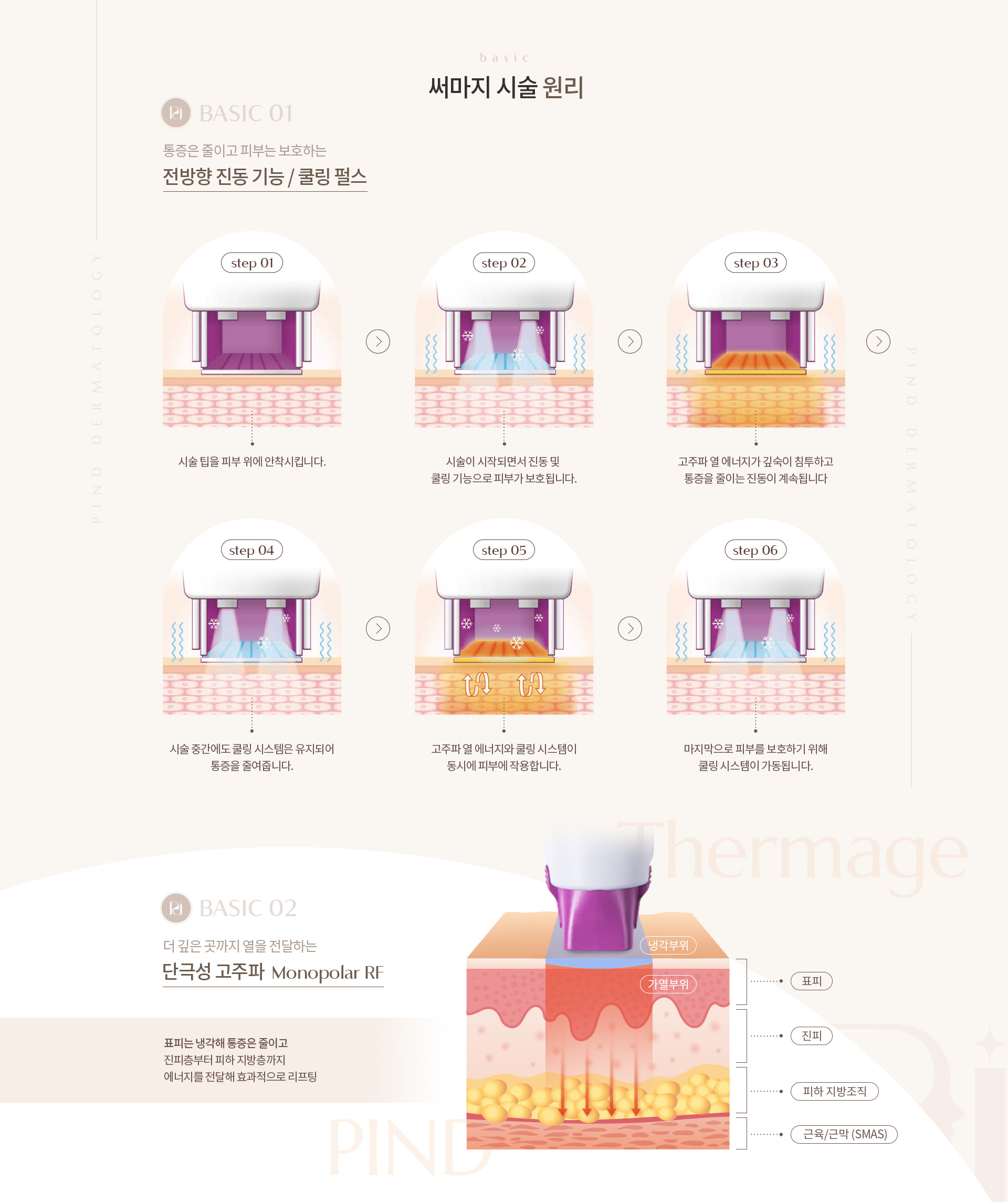 써마지 리프팅 상세03