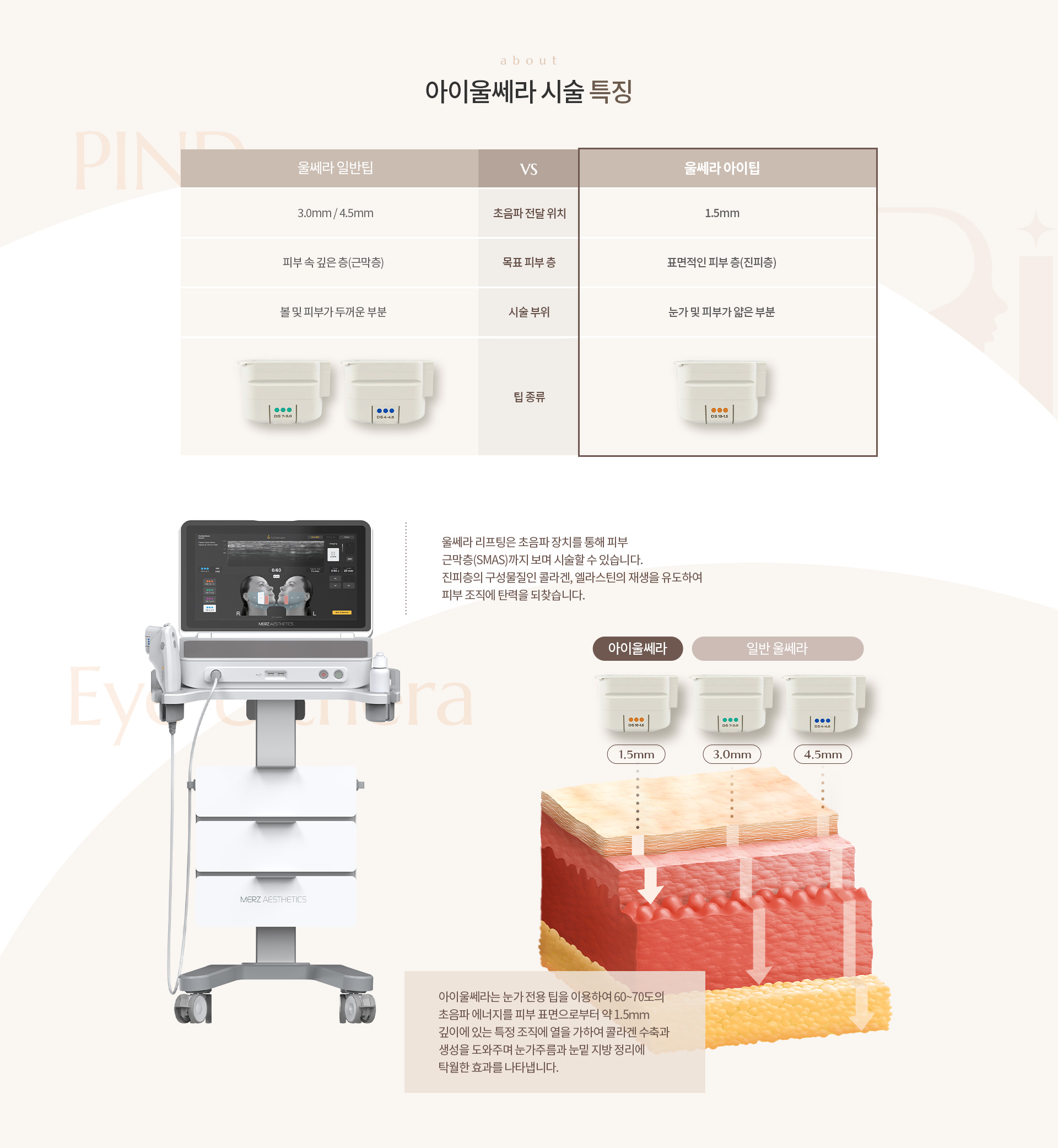 아이울쎄라 상세03