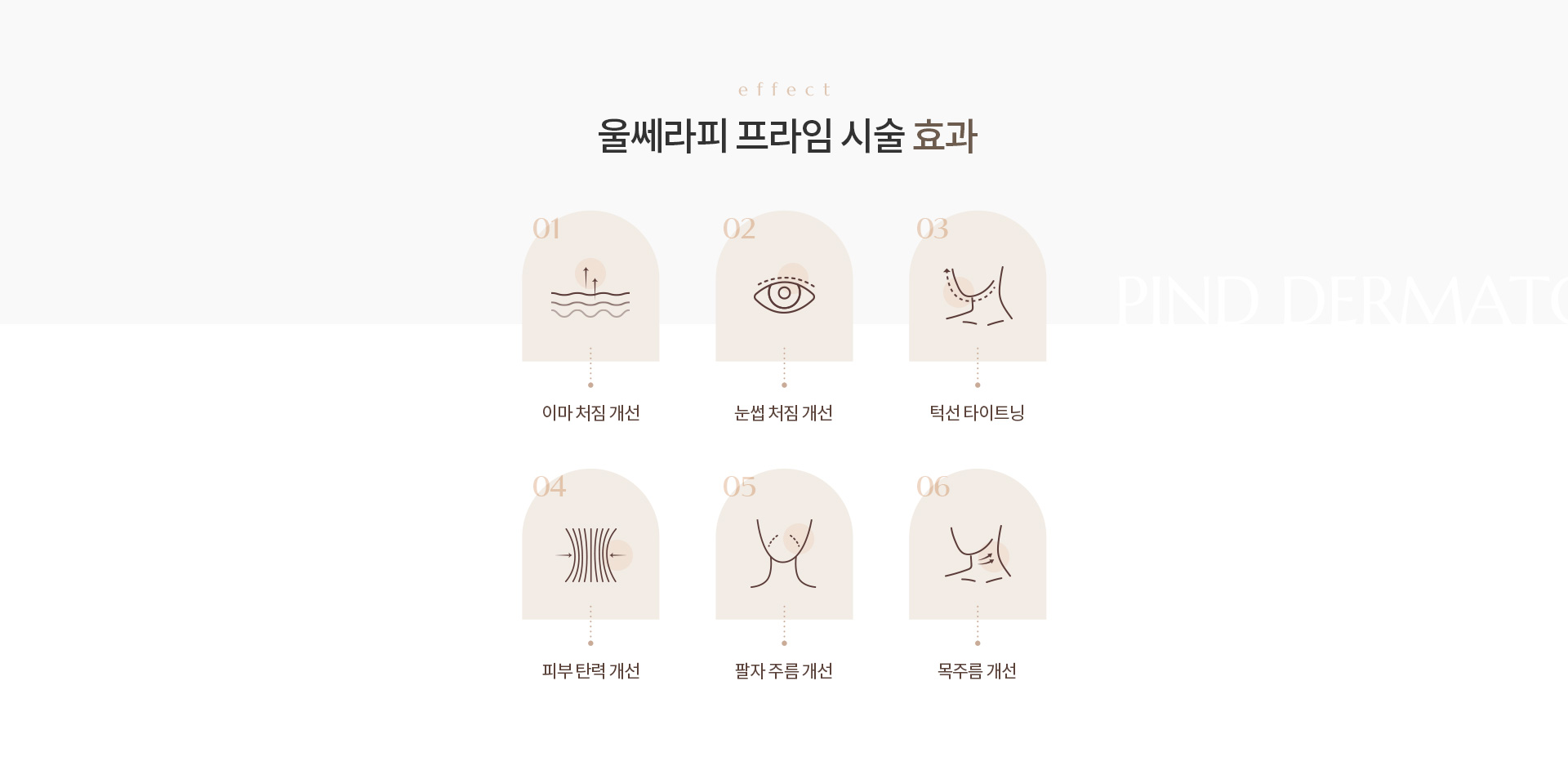 울쎄라 리프팅 상세04
