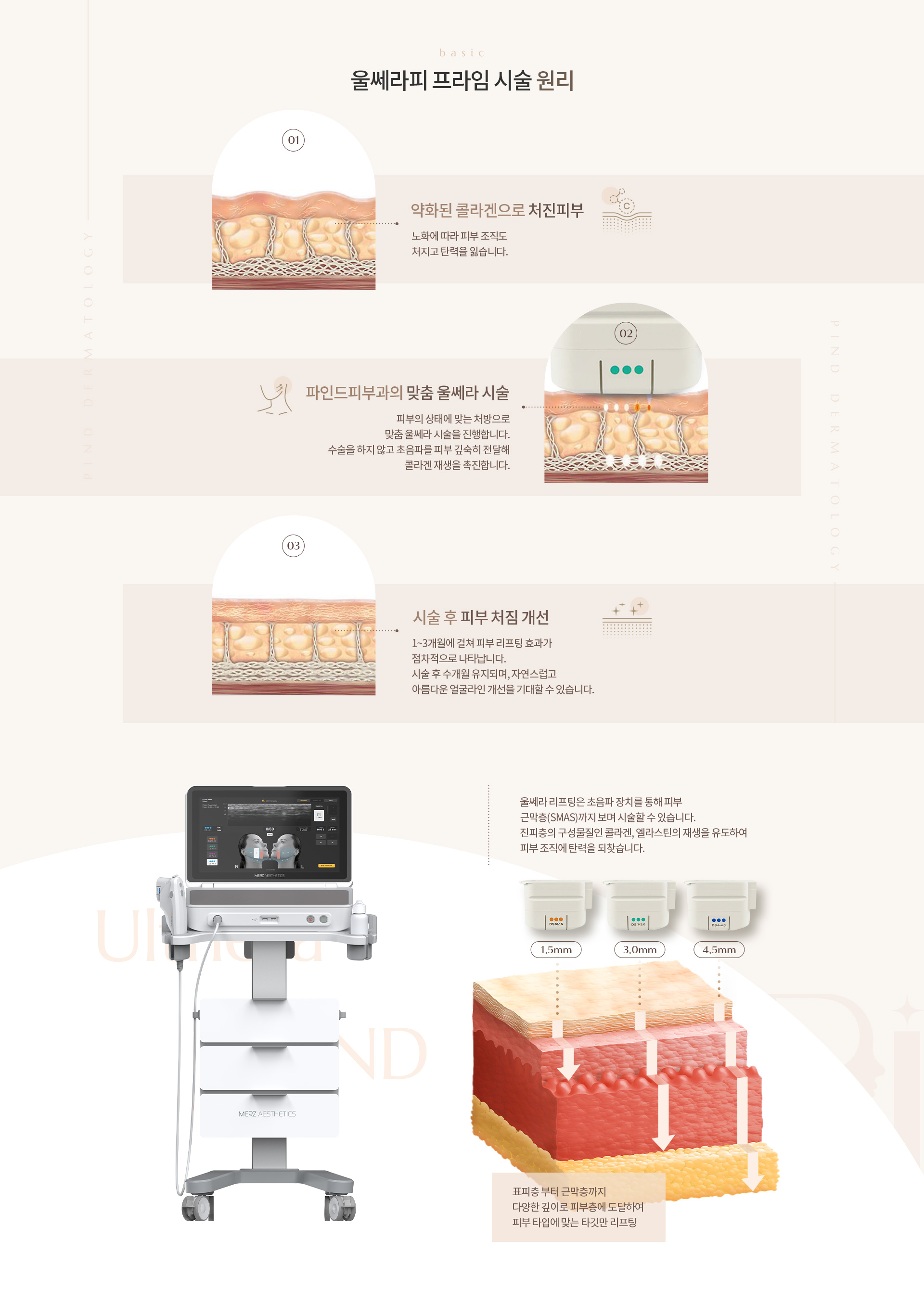 울쎄라 리프팅 상세05