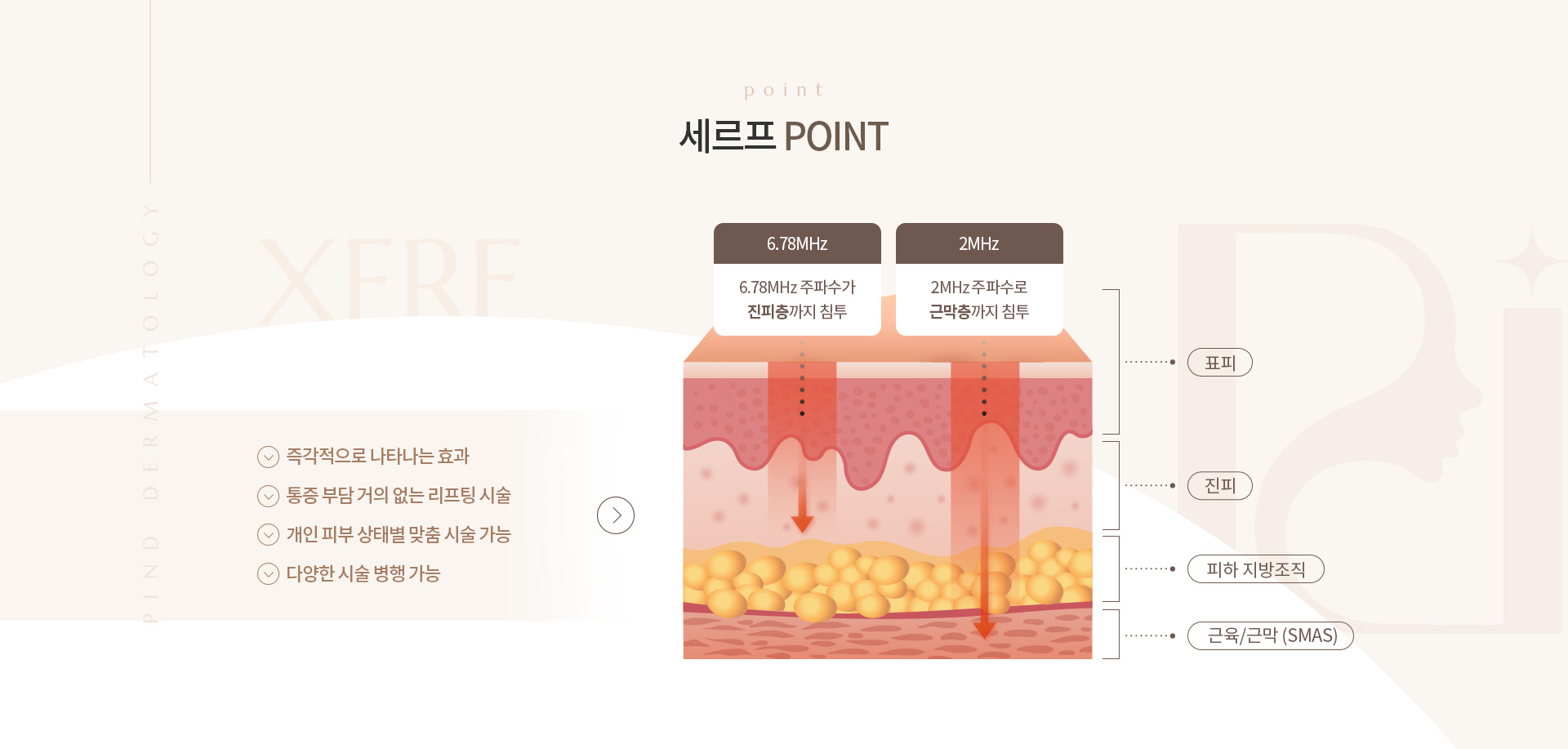 세르프 상세01
